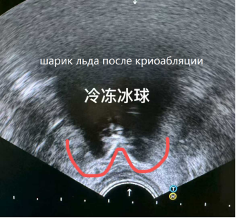 fuda15_583506.png image.png